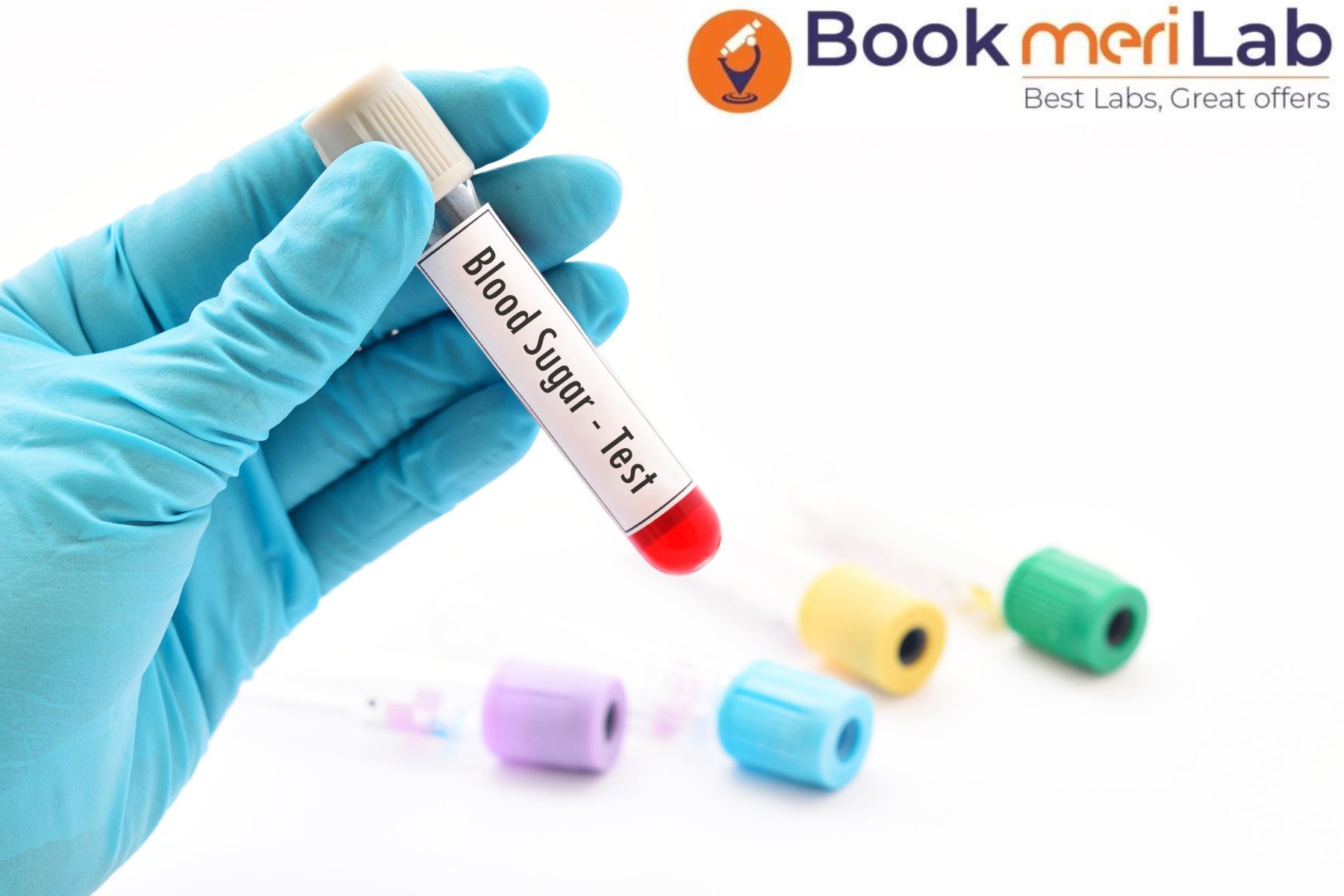 "Decoding The Sugar Test: Understanding Blood Glucose Monitoring For Health"